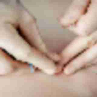 Battling Seasonal Allergies? Try Acupuncture (dedicated)