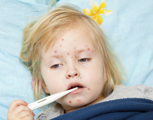 Measles: An Infectious Disease Expert Breaks it Down