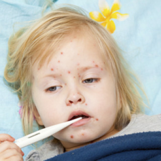 Measles: An Infectious Disease Expert Breaks it Down